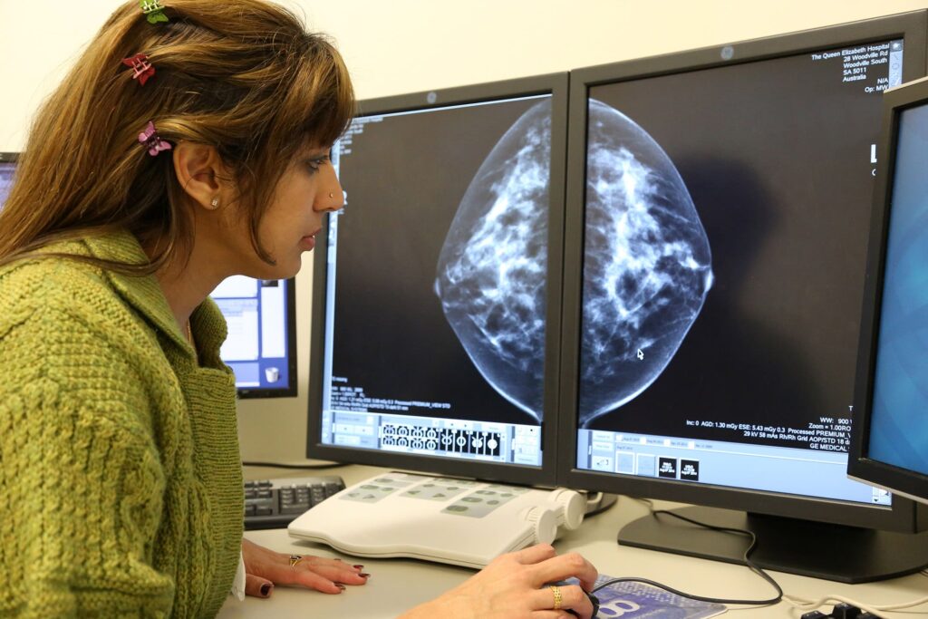 Supplemental MRI Screening for Women with Extremely Dense Breast Tissue ...